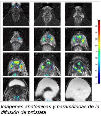 imágenes-anatómicas-próstata