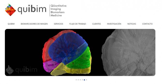 infografía-tomografía-quibim